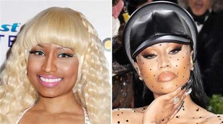 Nicki Minaj Before Bleaching Skin: Unveiling The Transformation