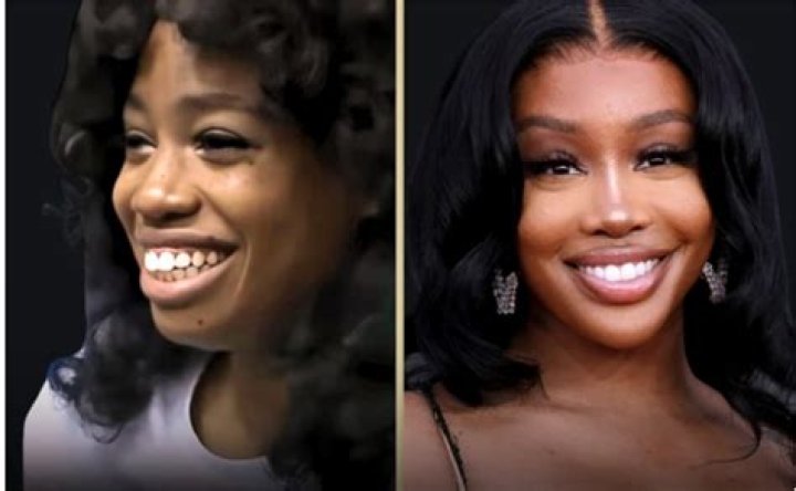 The Truth Behind The Plastic Surgery Rumors